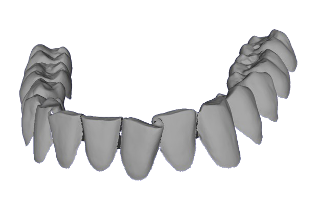 Segmented lower crowns (combined in a single file)