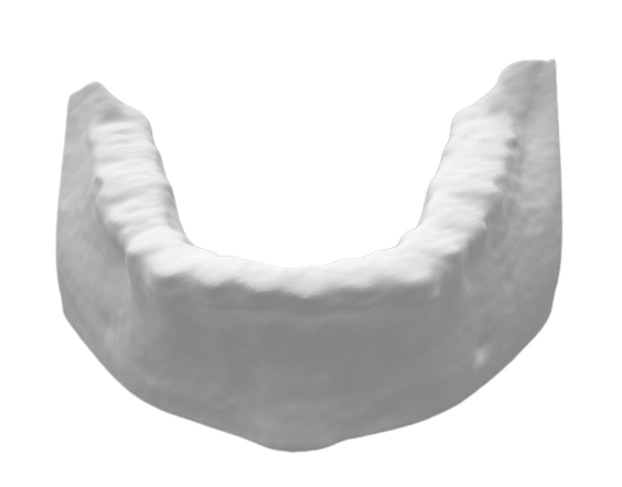 Segmented mandibular bone